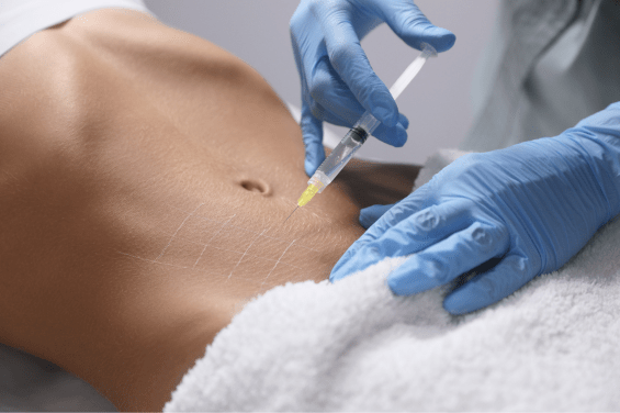 sunekos antwerpen lichaam