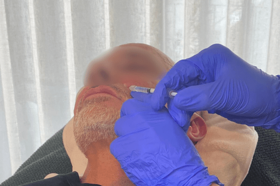 sunekos antwerpen onder ogen-min