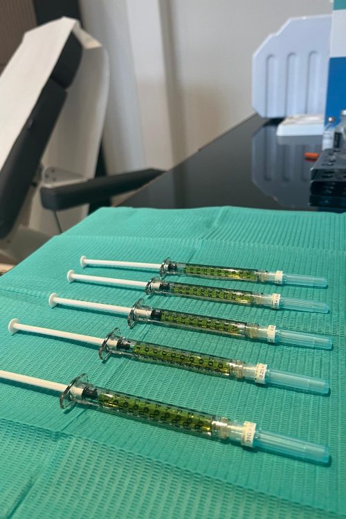 Voorbereiding van de PRP spuitjes